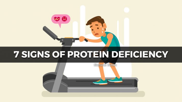 7 Signs Of Protein Deficiency 1722